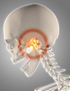 dolor articulacion temporo mandibular ATM 