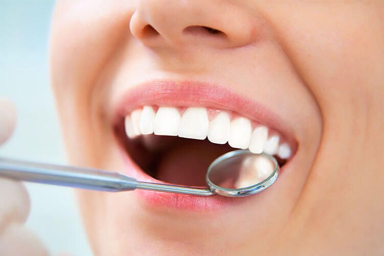 Estética dental: La erosión dental