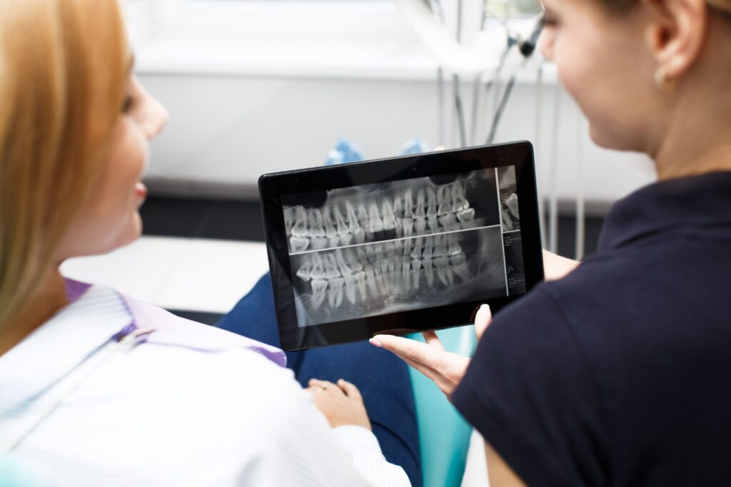 Radigrafía para implante dental